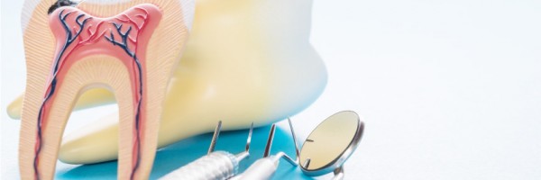 Do You Need A Root Canal Treatment Before Getting A Crown Or Bridge?